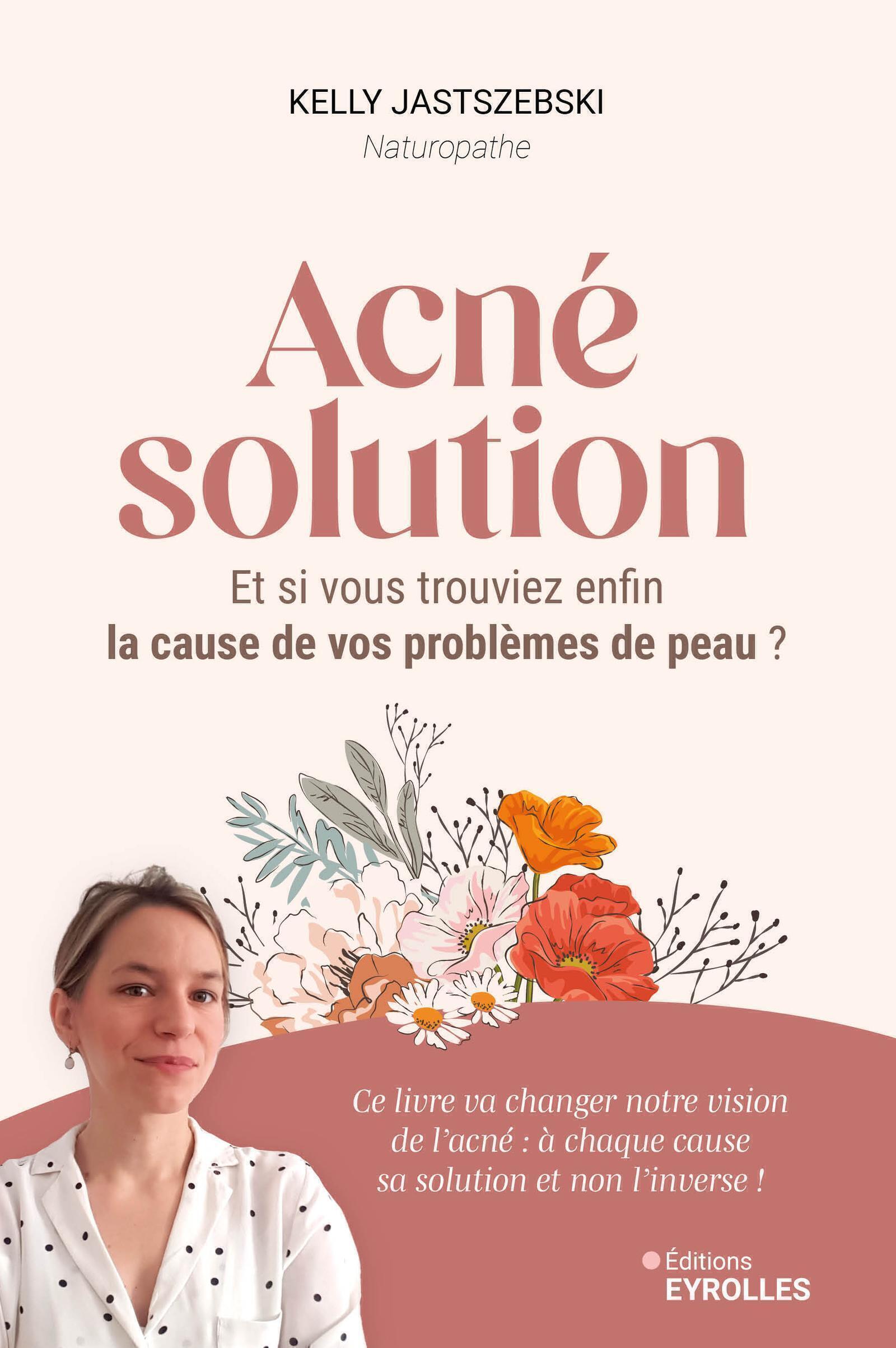 ACNE SOLUTION - ET SI VOUS TROUVIEZ ENFIN LA CAUSE DE VOS PROBLEMES DE PEAU ?